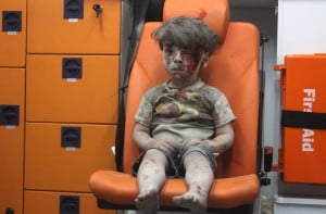 A Wounded Child In Aleppo, Silent And Still, Shocks The World